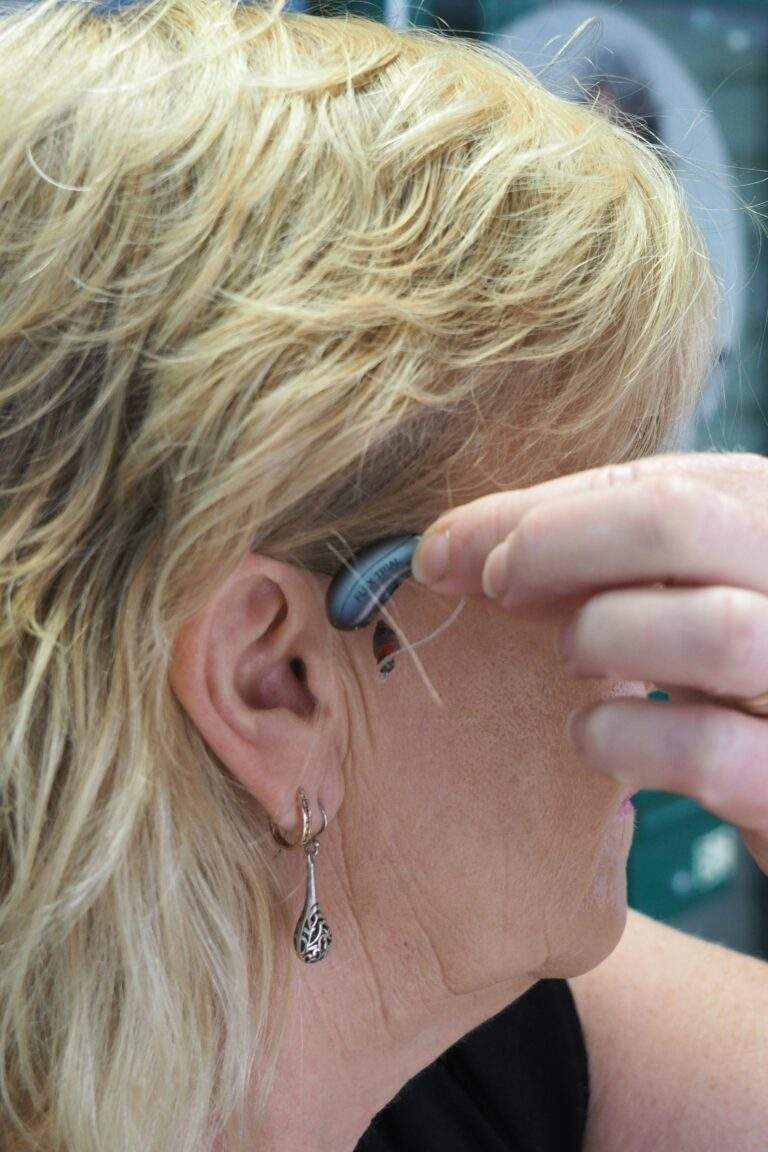 what are otc hearing aids